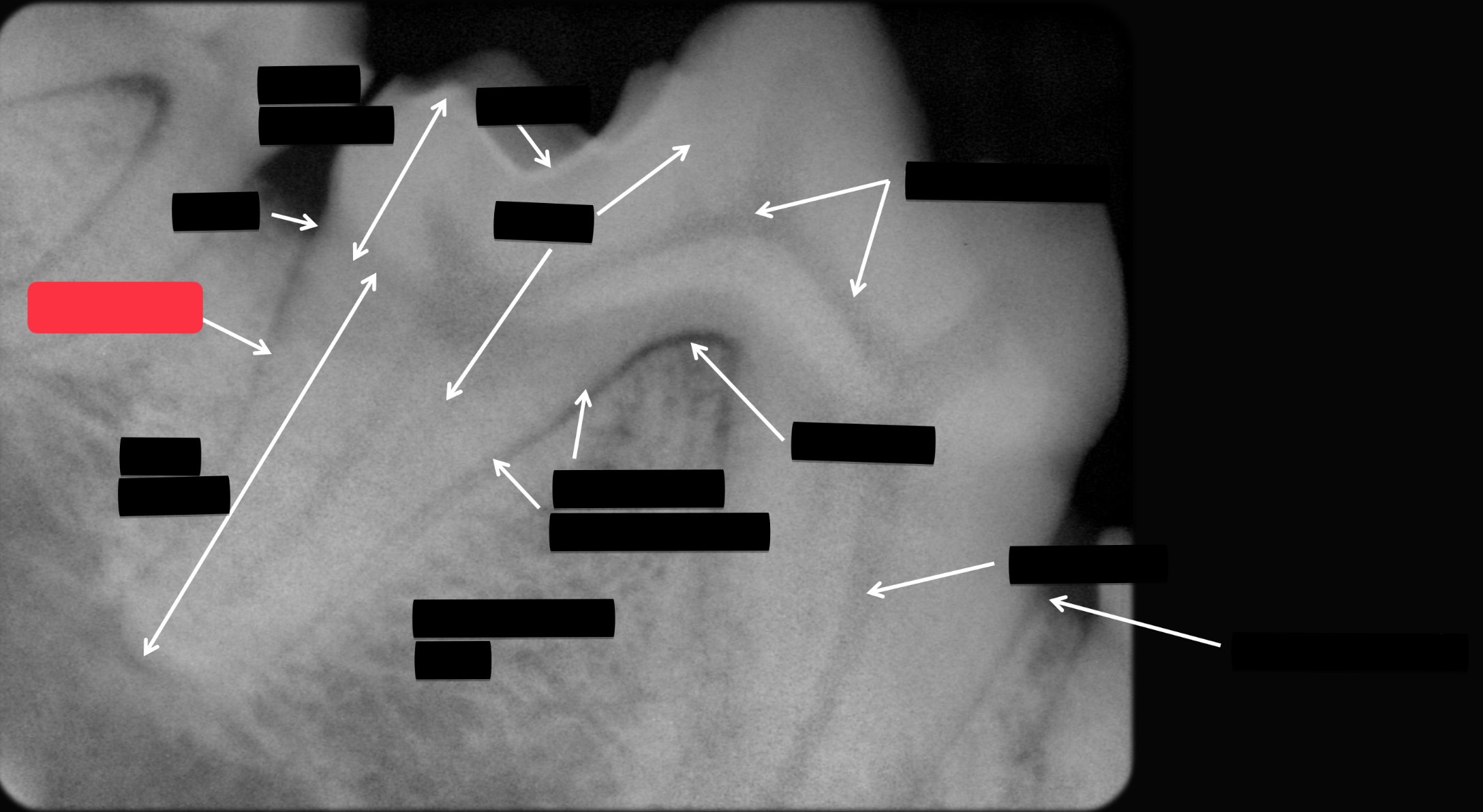 <p>Label this part of the tooth.</p>