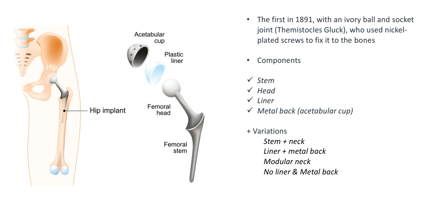<p>stem, head, liner, metal back (acetabular cup)</p>