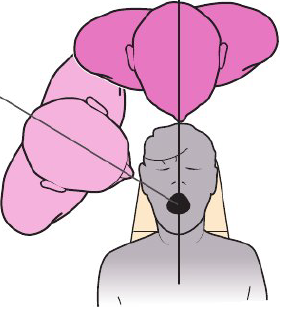 <p>Seated clinician can move around the patient to maintain neutral body posture</p><ol><li><p>Neutral possture for clinician’s head, arms, wrists, and hands</p></li><li><p>Visibility of tooth surfaces</p></li></ol><p></p>