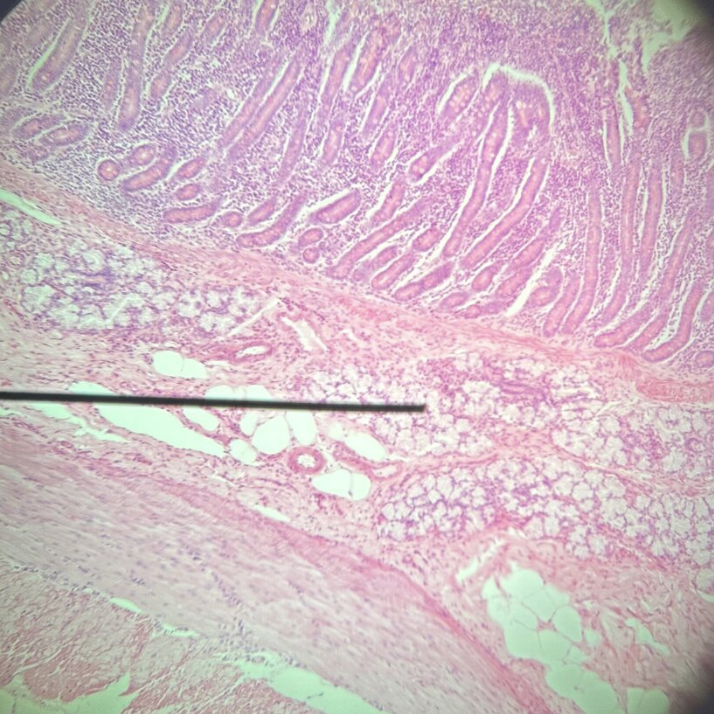 <p>Which segment of the digestive tract is this?</p>