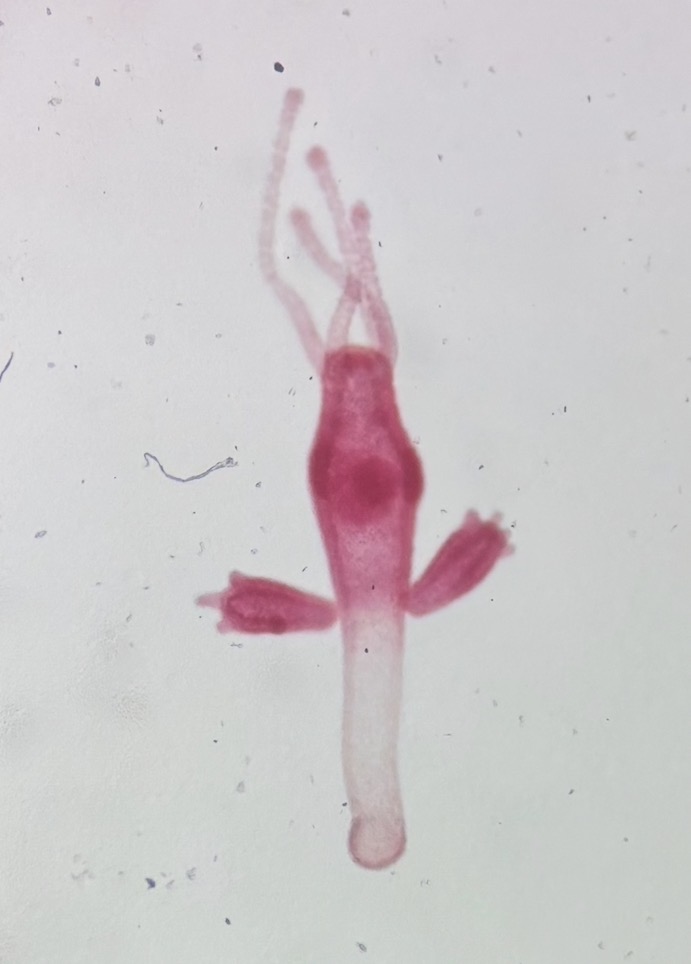 <p>What phylum and class is this? What stage is this?</p>