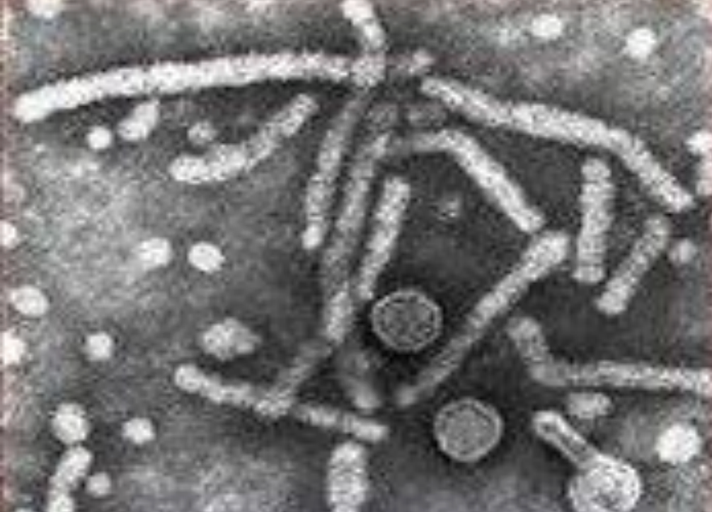 <p>hepatitis that exists in 3 forms</p>