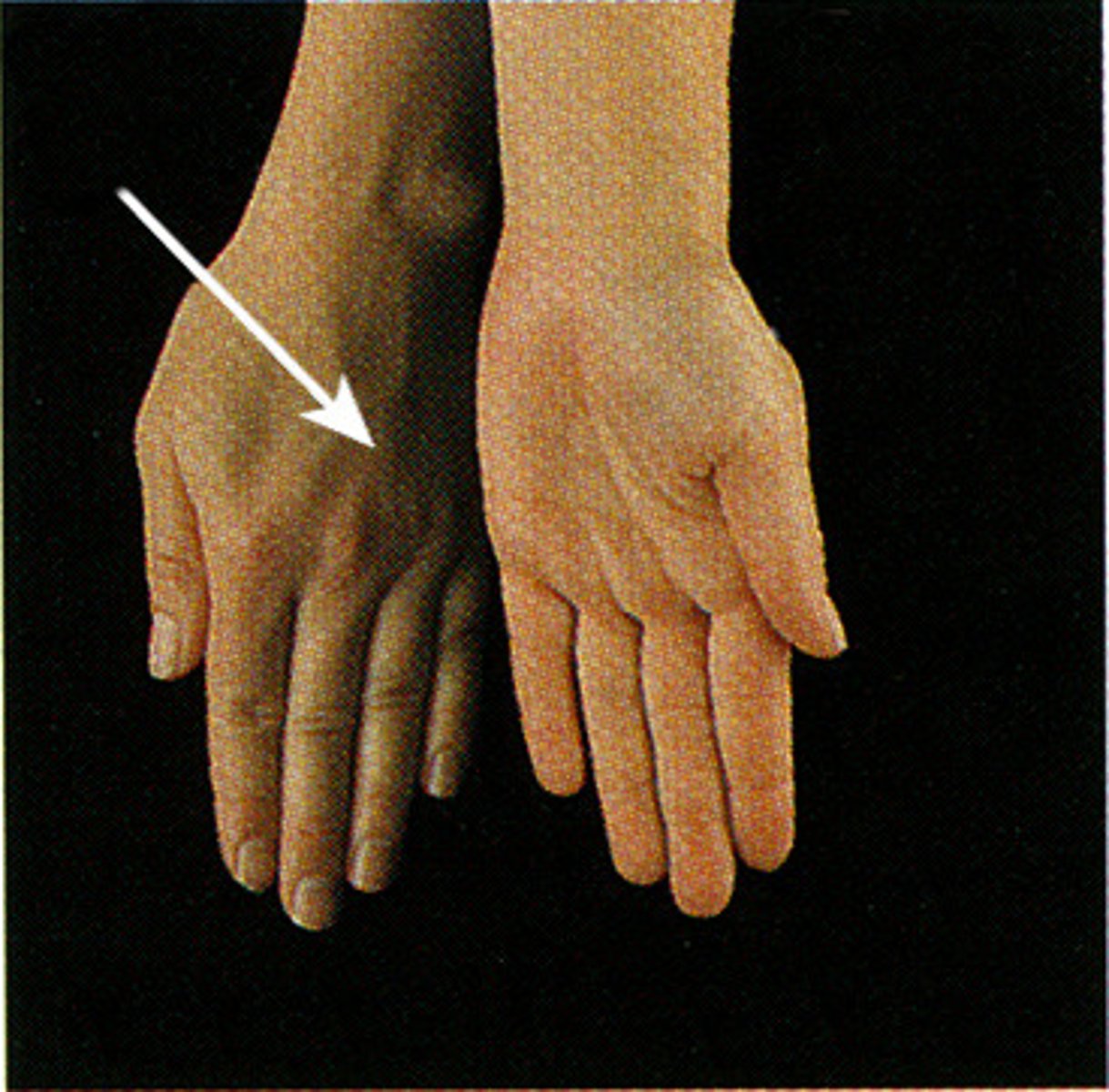 <p>turning the palm downward</p>
