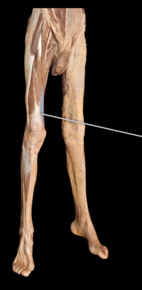 <p>What muscle is this?</p>
