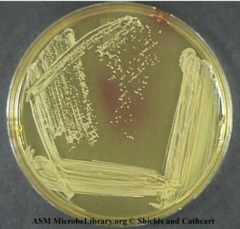<p>Why is Mannitol Salt Agar differential?</p>
