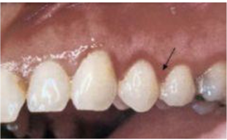 <p>CHẨN ĐOÁN ?</p>