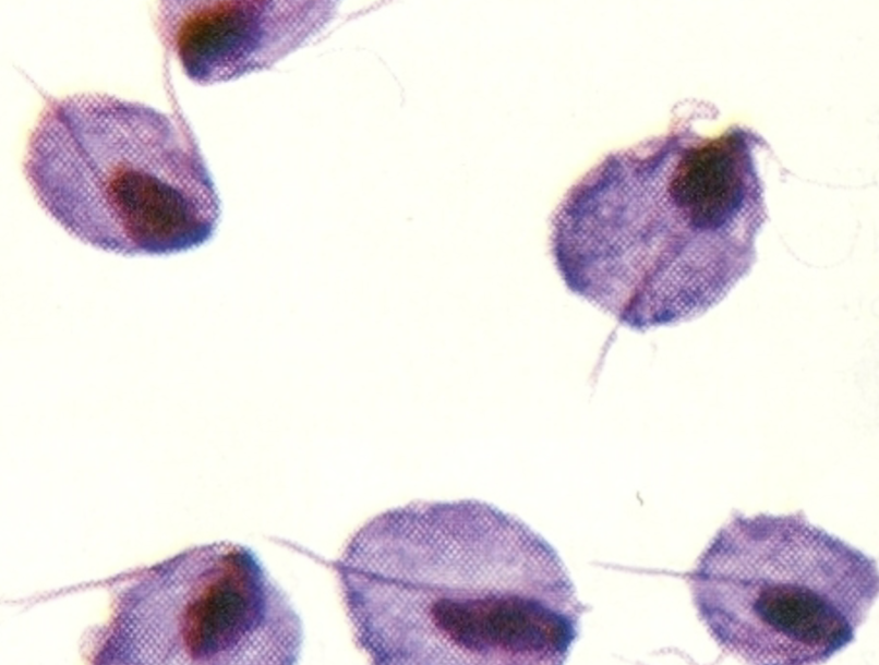 <p>What protist is this?</p>