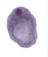 <p>What Amaeba is this?</p>