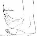 <p>Plantar flexion</p>