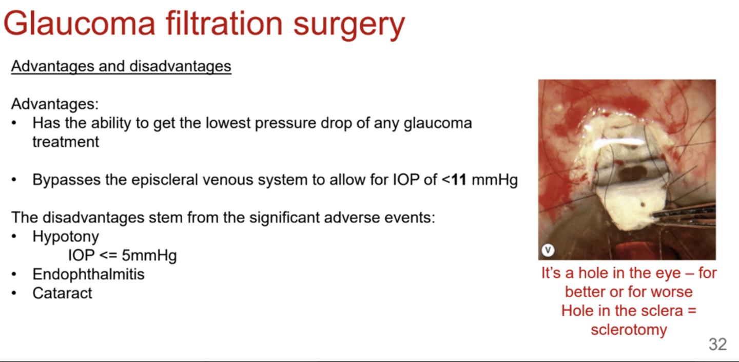 <p>What are the advantages of glaucoma filtration surgery?</p>