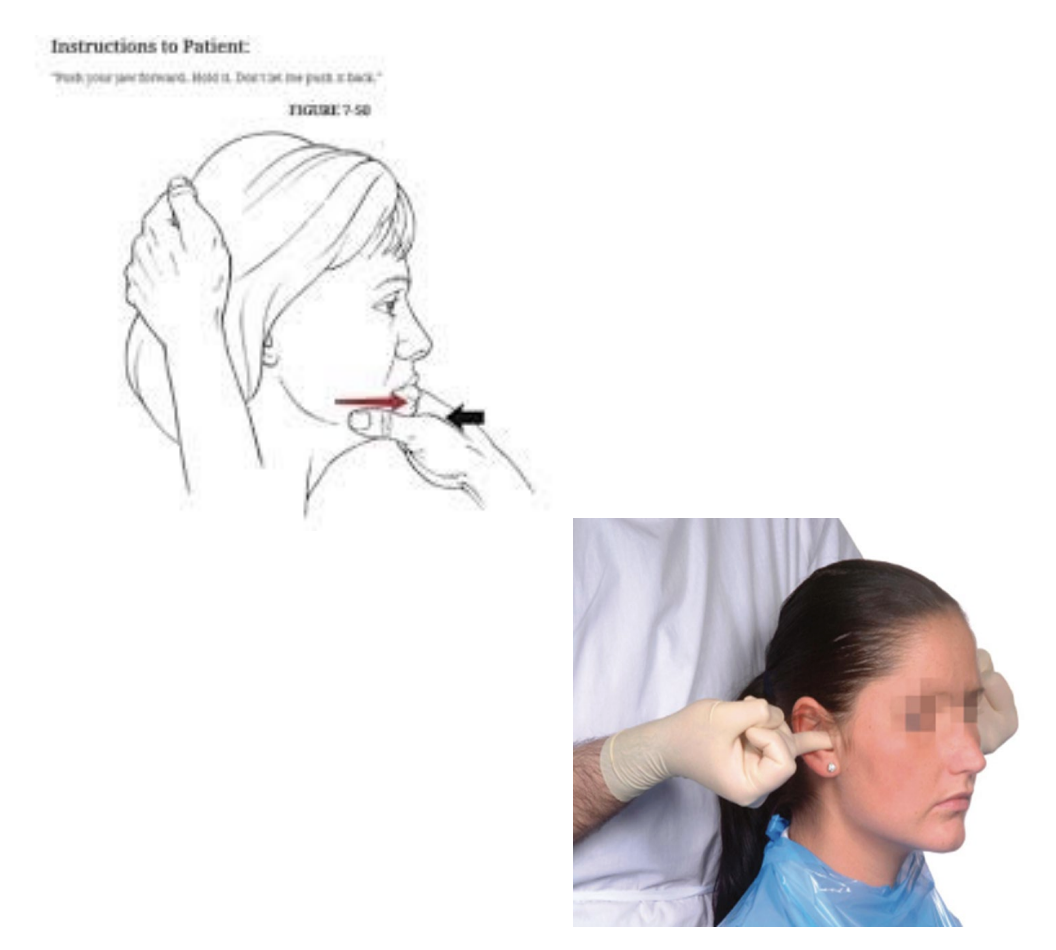 <p>• Resistance is applied against forward jaw movement to test the lateral pterygoids. </p><p>• For retrusion, resistance is applied posterior on the mandibular condyle</p>