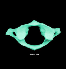 <p>C1</p>
