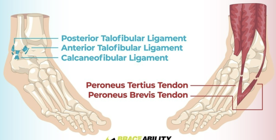 <p>the left foot injury in the image is ________, the right foot is a ________</p>