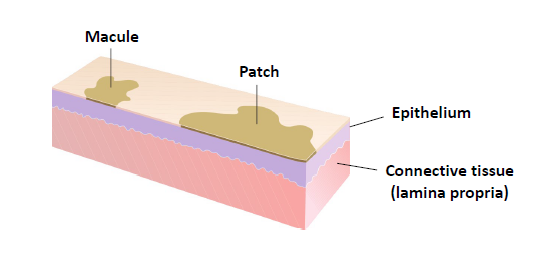 <p>more than 1 cm in diameter</p>