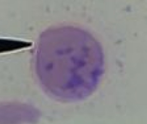<p>Name stage of erythropoiesis</p><p>What stain ?</p>