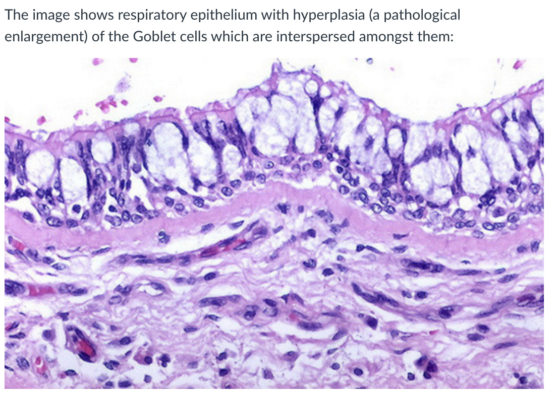 <ul><li><p><strong>Goblet cell hyperplasia:</strong></p><ul><li><p>Pathological <strong>increase in number/size of goblet cells</strong></p></li><li><p>Leads to <strong>excess mucus production</strong> in respiratory epithelium</p></li></ul></li><li><p><strong>Bronchioles definition (more precise):</strong></p><ul><li><p>Distal airways <strong>between cartilage-walled bronchi and the point where ciliated epithelium ceases</strong></p></li></ul></li><li><p><strong>Alveolar ducts structure:</strong></p><ul><li><p>Passageways <strong>formed mostly from openings of alveoli</strong></p></li><li><p>Lined with <strong>flattened epithelium</strong></p></li></ul></li></ul><p></p>