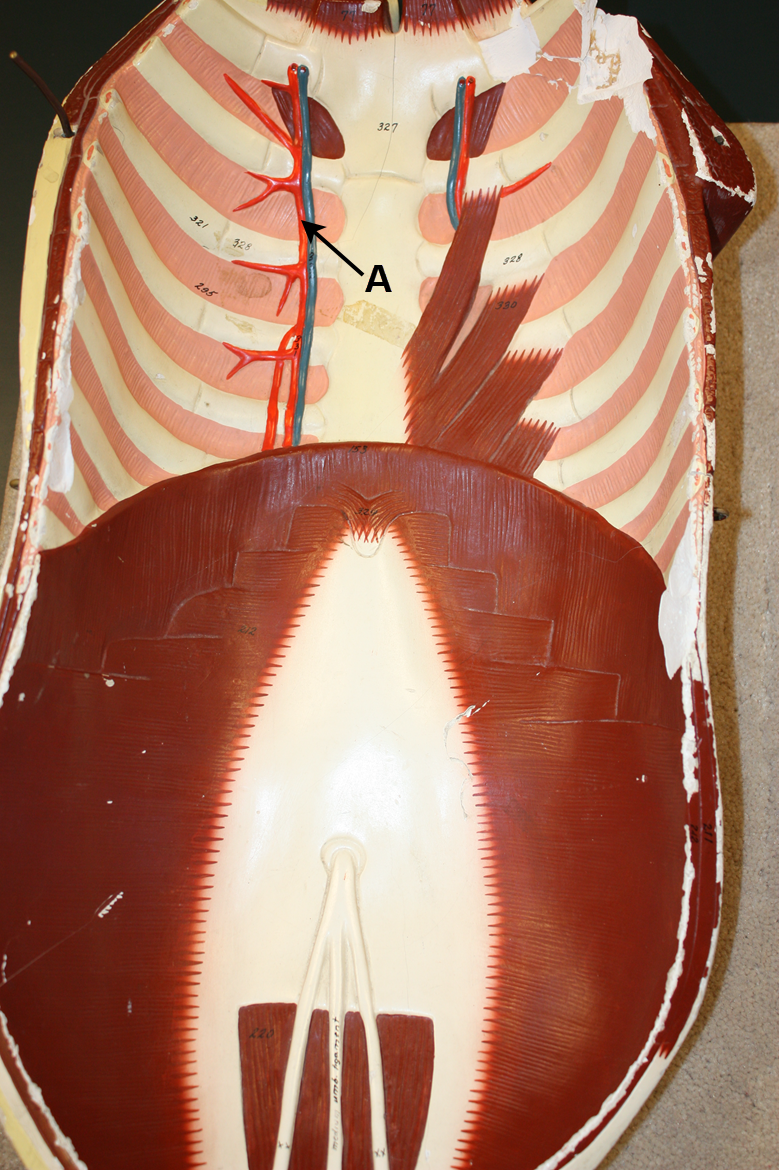 <p>I<span>n the image above (which is the inside of the anterior wall of the ventral cavity), identify blood vessel A (it's red).</span></p>