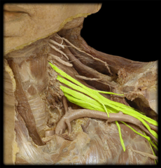 <p>Identify the structure</p>