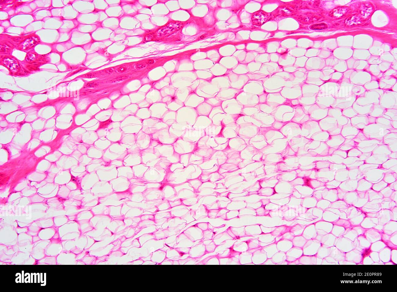 <p>What type of tissue is this?</p>