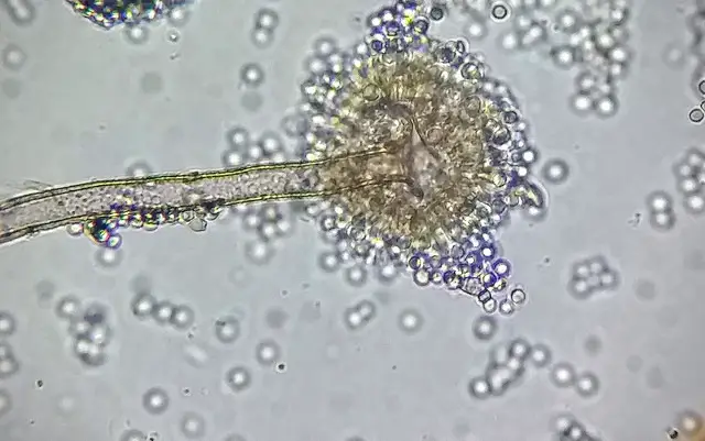 <p>What cell slide is this, and is it a prokaryote?</p>