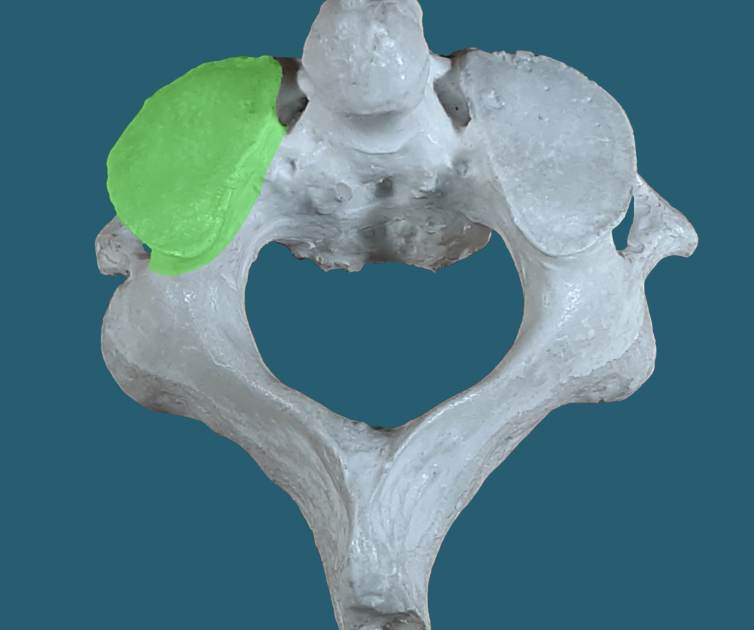 term image