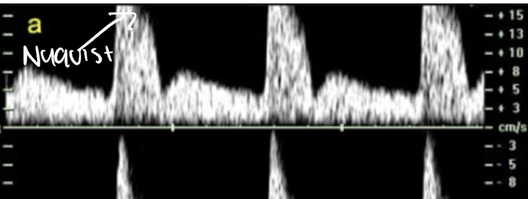 <p>nyquist limit. the top cannot be measured because it goes beyond what can be displayed</p>