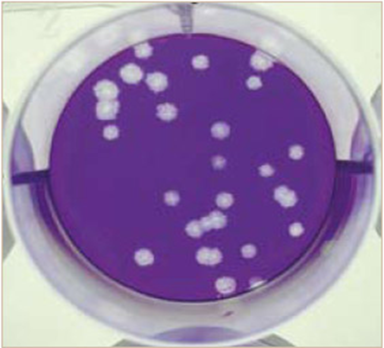 <p>A <strong>plaque assay</strong> measures the number of <strong>infectious virus particles</strong> in a sample.</p><p>A virus solution is added to a <strong>monolayer of host cells</strong>, where infection and <strong>cell lysis</strong> create <strong>clear zones called plaques</strong>.</p><ul><li><p>each plaque represents one virion</p></li></ul><p></p>