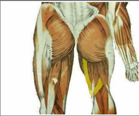 <p>What muscle is the highlighted region depicting? what is its innervation?</p>