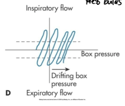 <p>what type of tracing is this </p>