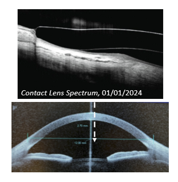 <p>Keep measurements parallel to the scanning beam</p>