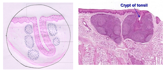 <p>Epithelium lining tonsils indents deeply in several locations</p><ul><li><p>Trap bacteria and debris</p></li><li><p>Tonsil location puts them into contact with a large number of potential pathogens </p><ul><li><p>Commonly become inflamed when they trap too much</p><ul><li><p>Tonsilitis </p></li></ul></li></ul></li></ul><p></p>