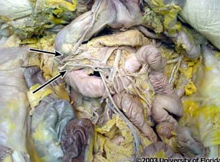 <p>what structure is pictured (be specfic; context: transverse colon and stomach have been reflected)?</p>