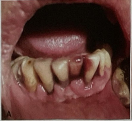 <p>CHẨN ĐOÁN </p>