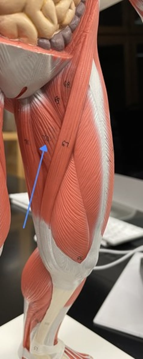 <p>adductor longus 70 </p><p>origin:</p><p>insertion:</p><p>action:</p>