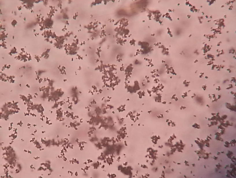 <p>Identify the crystals here. What does this finding commonly indicate? The pH is 6.0</p>