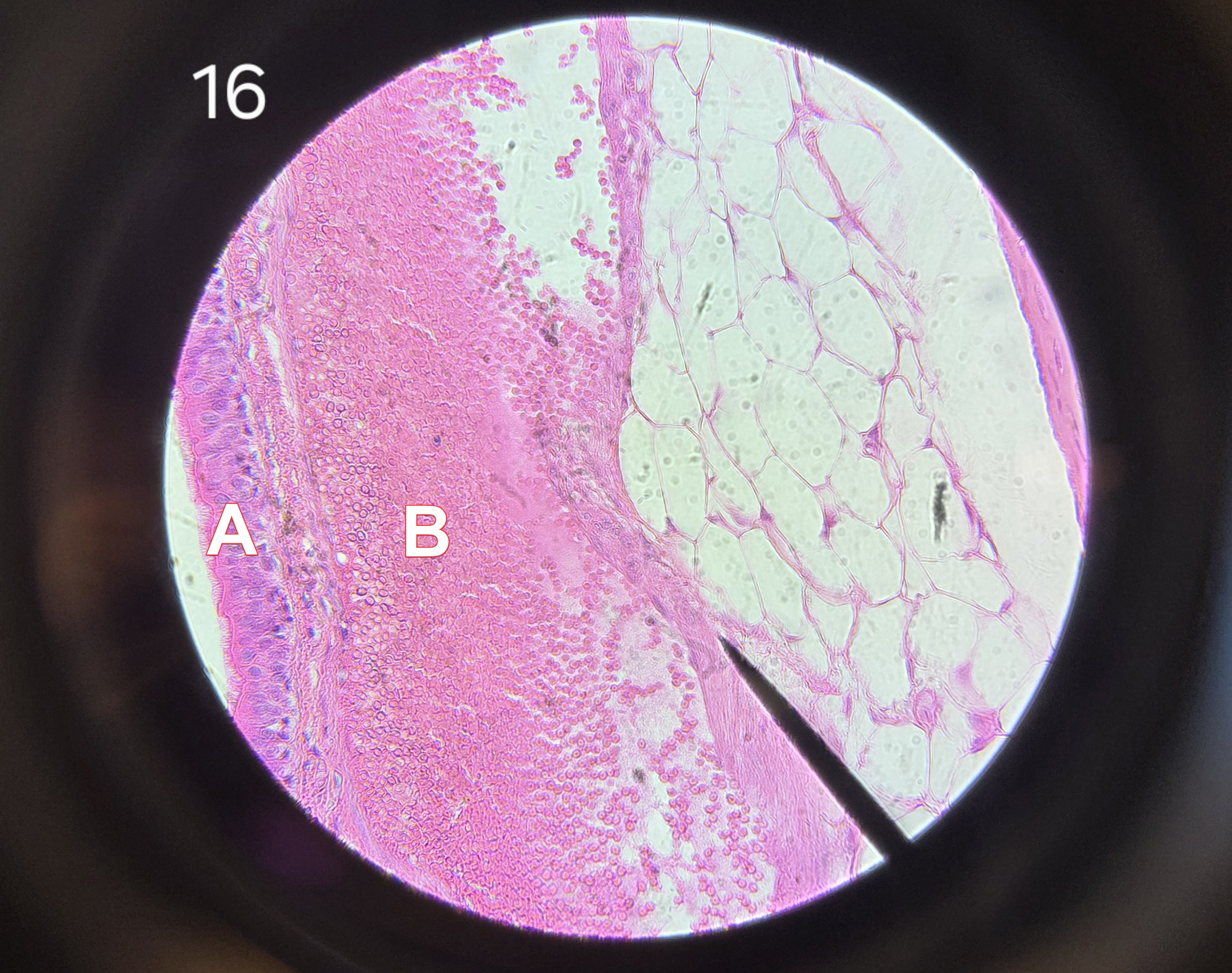 <p>In the zoomed-in histology slide of the trachea, <strong>Label A</strong> is the…</p>