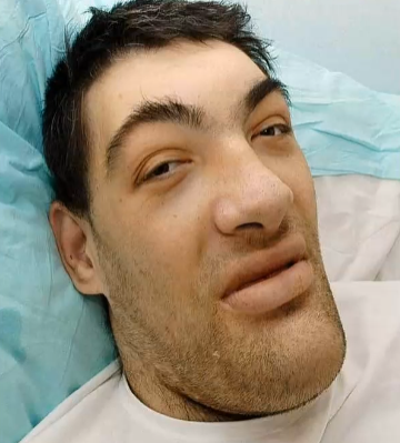 <p>¿Que facie presenta?</p>