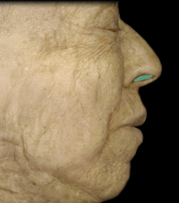 <p>Identify the feature of the nasal cavity</p>