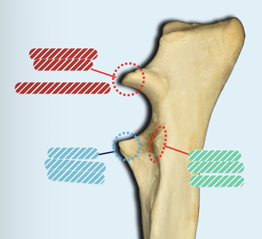 <p>Identify the bone and the structure (red)</p>