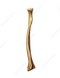 <p>What bone is this?</p>