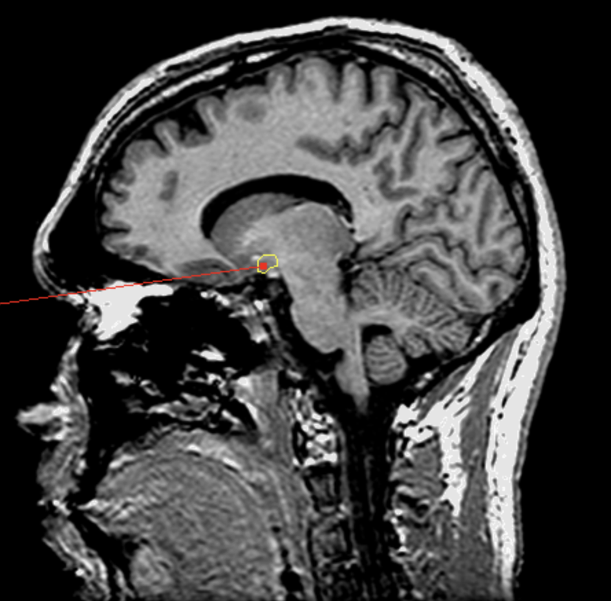 <p>What is the area highlighted called?</p>