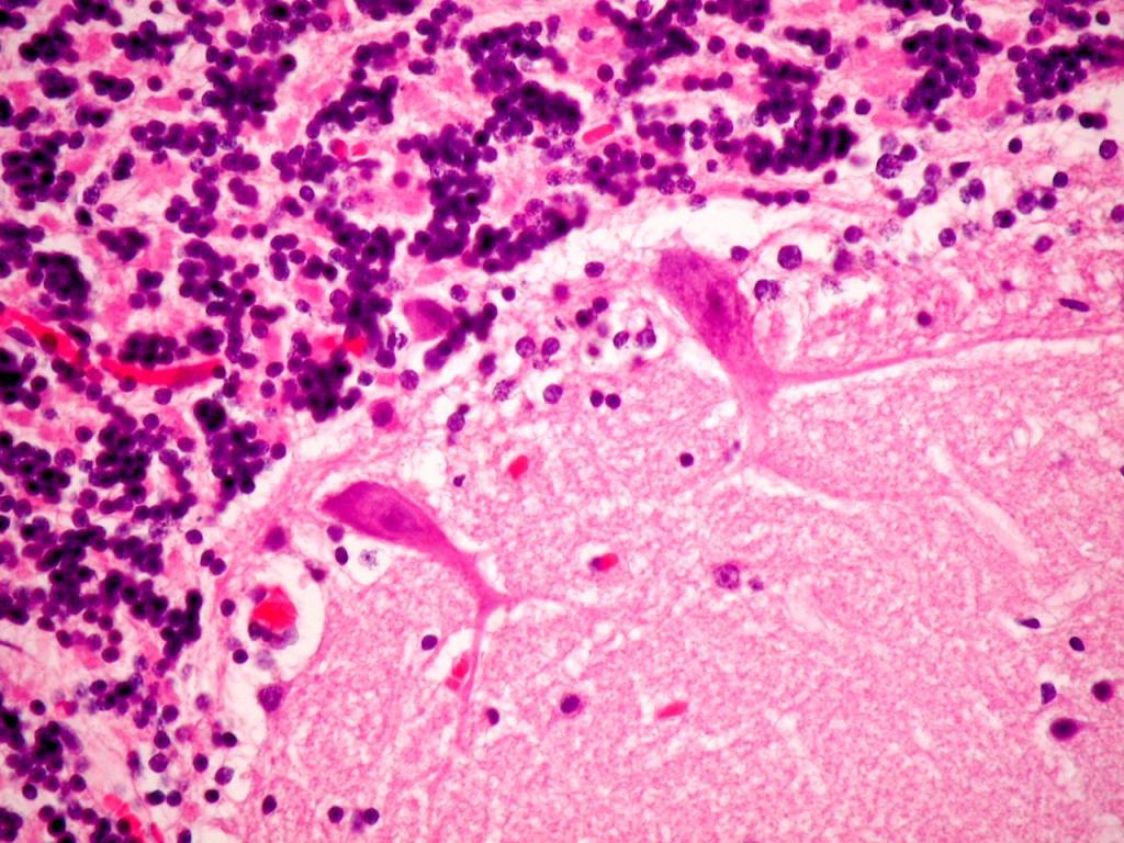 <p>Identifica la plaquita</p>