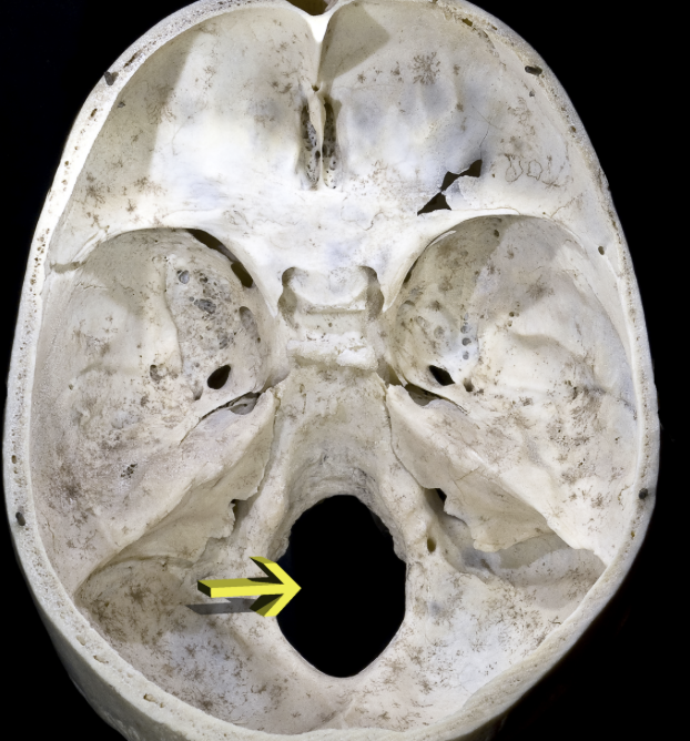<p>A hole or opening in a bone, usually for nerves or blood vessels</p><p>The _____ magnum is the large opening in the occipital bone at the base of the skull where the spinal cord passes.</p>