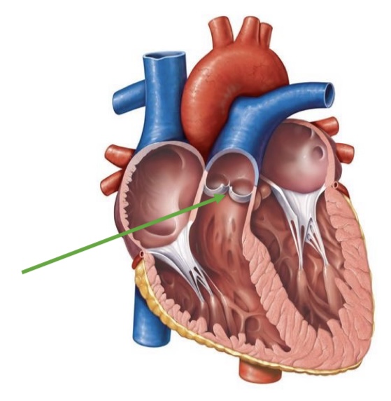 term image