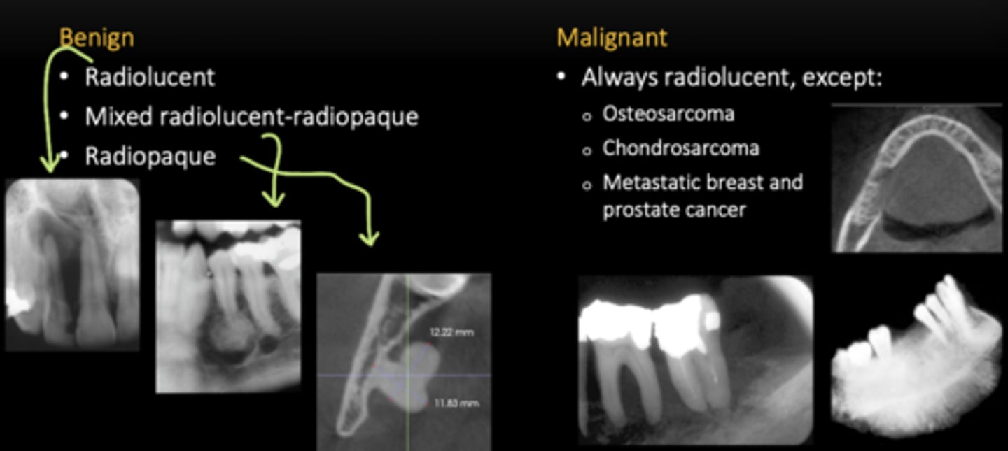 <p>Benign: can be any of...</p><p>- Radiolucent</p><p>- Mixed RL-RP</p><p>- Radiopaque</p><p>Malignant: ALWAYS radiolucent, except...</p><p>- Osteosarcoma </p><p>- Chondrosarcoma </p><p>- Metastatic breast and prostate cancer </p>