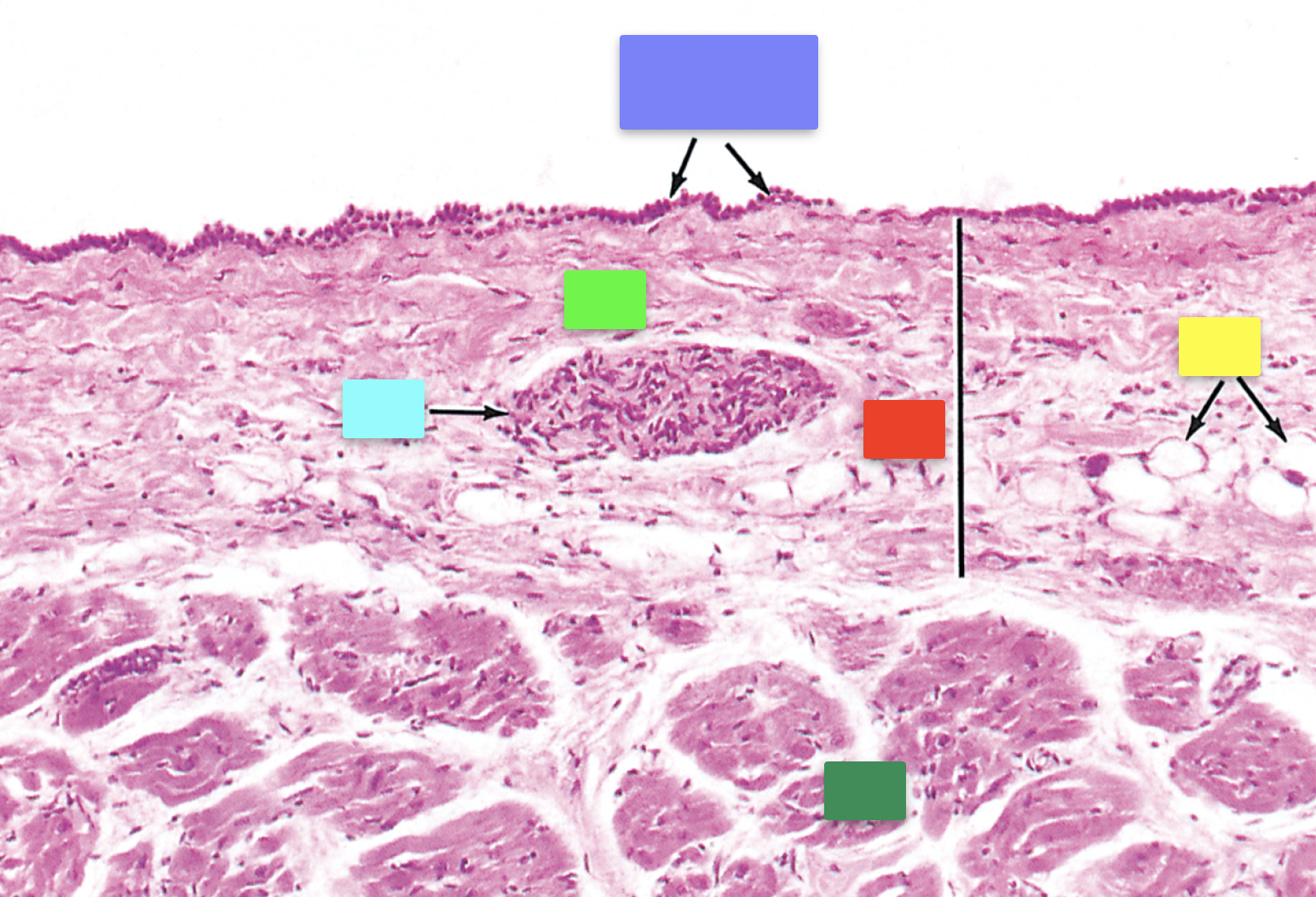 <p>Identify the structure indicated by the light green box (area surrounding it)</p>