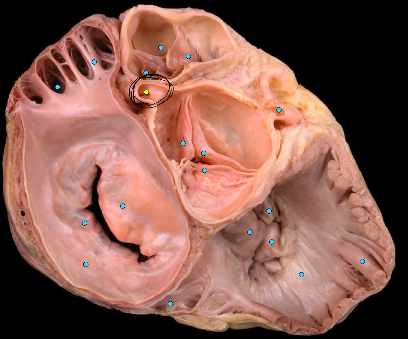 term image