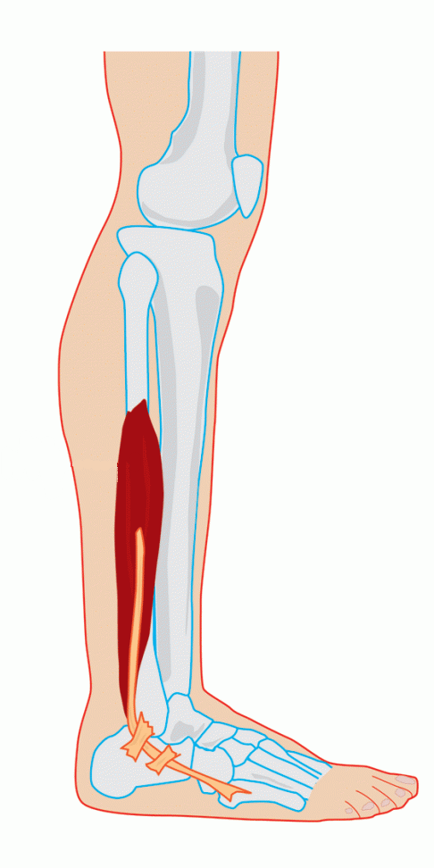 <p><span>distale 1/2 facies lateralis fibulae</span></p>