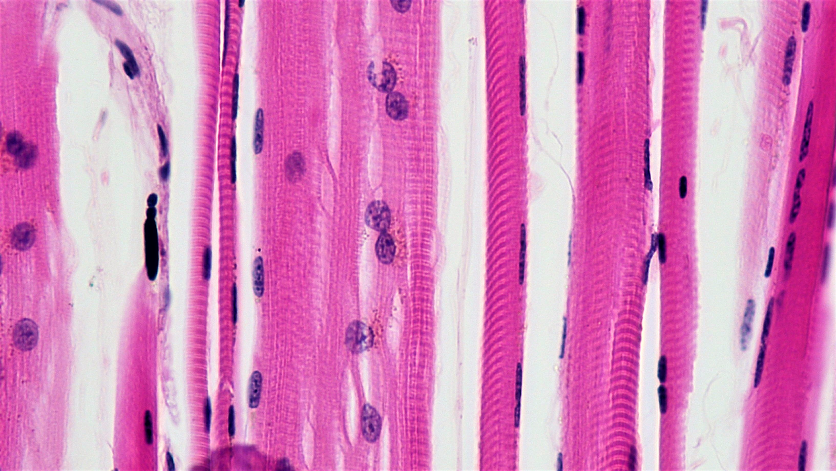 <p>Skeletal Muscle</p>
