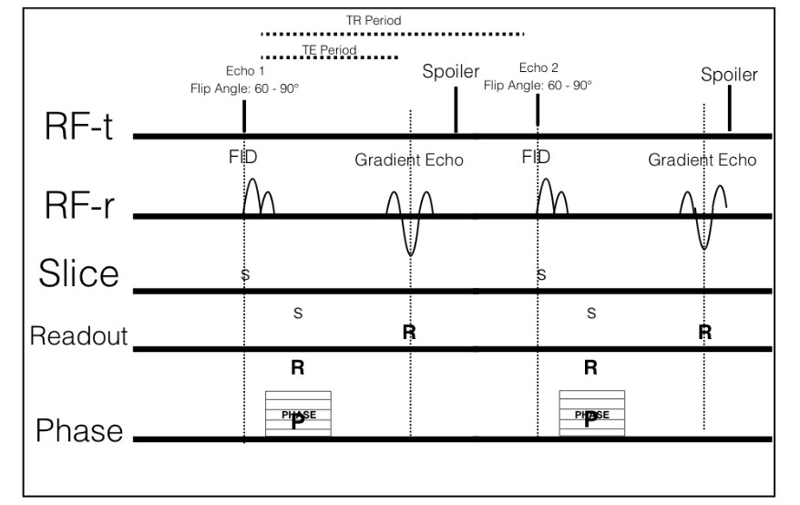 <p>Fast GRE timing sequence</p>